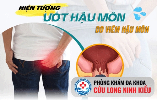 Hậu môn ẩm ướt có mùi hôi là bệnh gì?