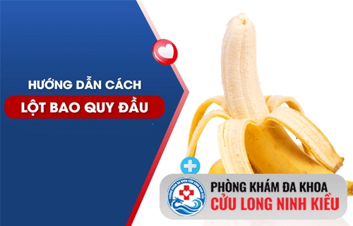 Cách lột bao quy đầu hiệu quả