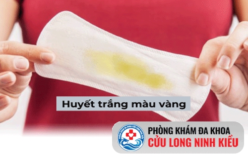 Huyết trắng màu vàng nguyên nhân là do đâu?