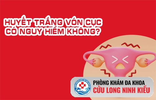 Huyết trắng vón cục có nguy hiểm không