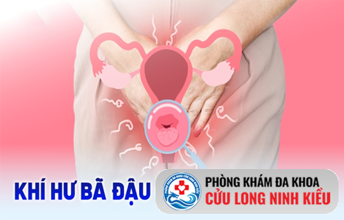 Bạn đang khổ sở vì khí hư bã đậu? Đọc ngay để tìm cách điều trị hiệu quả