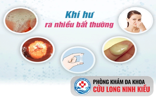 Cần biết - Nguyên nhân Khí hư (Dịch âm đạo) ra nhiều