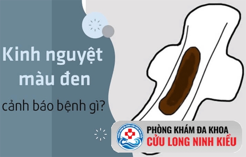 Kinh nguyệt màu đen nâu là bị gì? cách chữa trị hiệu quả