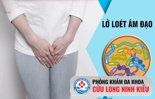 Lở loét vùng kín là biểu hiện của bệnh gì?