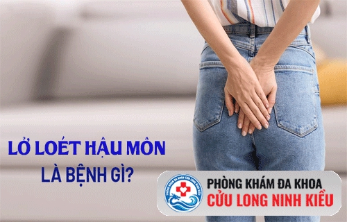 Lở loét hậu môn là biểu hiện của bệnh gì?