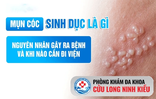 Mụn cóc sinh dục là gì?