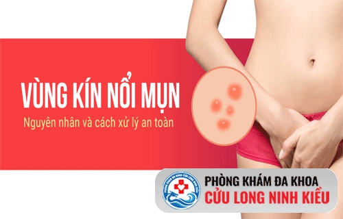 Mụn vùng kín- cảnh báo bệnh nguy hiểm