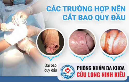 Cắt bao quy đầu - Những điều nam giới cần biết