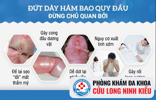 Đứt dây hãm dương vật cần phải làm gì?