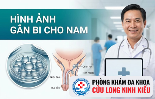 Quy trình thực hiện tiểu phẫu gắn bi vào dương vật như thế nào?