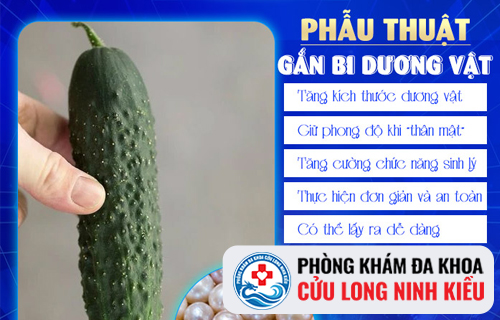 Có Nên Tiến Hành Gắn Bi dương vật ?
