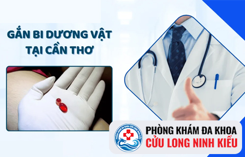 Địa Chỉ Gắn Bi Vào dương vật An Toàn ?