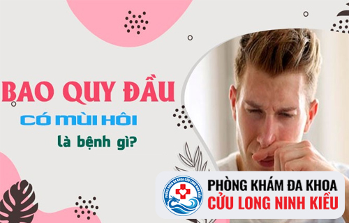 Hôi bao quy đầu là do đâu và cách điều trị như thế nào?