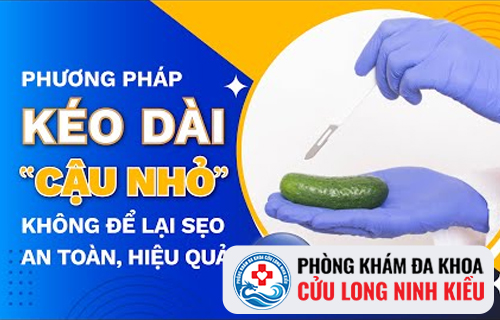 Địa chỉ kéo dài dương vật tốt nhất tại Cần Thơ