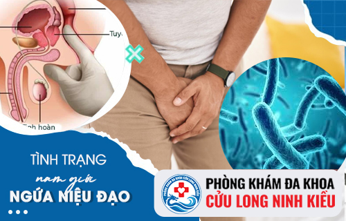 Ngứa lỗ niệu đạo là dấu hiệu của bệnh gì và cách điều trị ra sao?