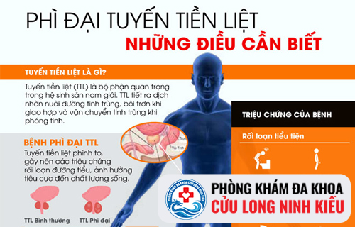 Tổng quan về bệnh phì tuyến tiền liệt