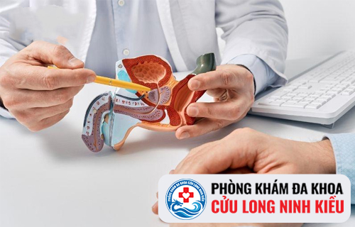 Địa chữa chữa phì đại tuyến tiền liệt tại Cần Thơ
