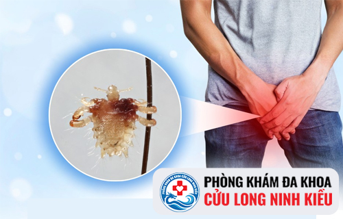 Chữa Rận Mu Tại Phòng Khám Đa Khoa Cửu Long Ninh Kiều