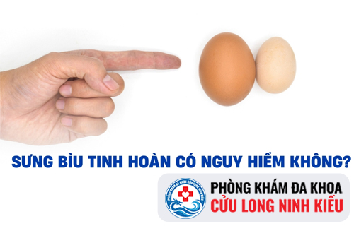 Trứng dái sưng đau bất thường là dấu hiệu của bệnh gì?
