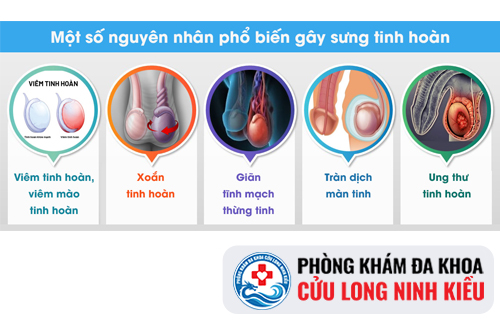 Cảnh Giác Với Triệu Chứng Sưng tinh hoàn Phải