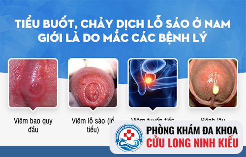 Nguyên nhân gây tiểu rát