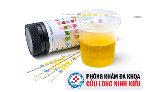 Vì sao nước tiểu lại bị đục màu?