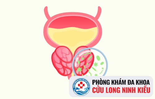 Đi tiểu khó là bệnh gì?