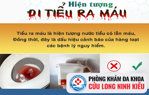 Cách chữa tiểu ra máu hiệu quả nhất không phải ai cũng biết