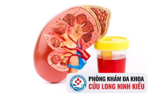 Chi phí chữa tiểu ra máu là bao nhiêu?