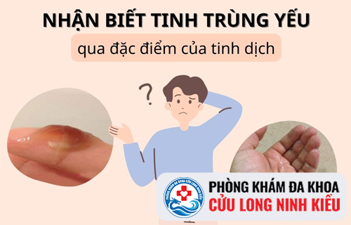 Nguyên nhân gây ra tình trạng tinh trùng yếu ở nam giới