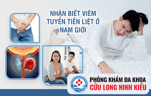 Các Phương Pháp Hỗ Trợ Điều Trị Viêm tuyến tiền liệt Hiệu Quả Hiện Nay