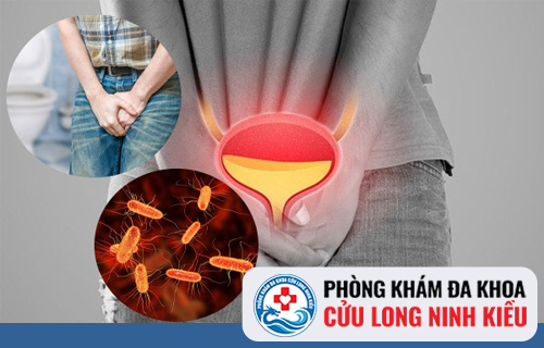 Những biểu hiện của bệnh viêm bàng quang