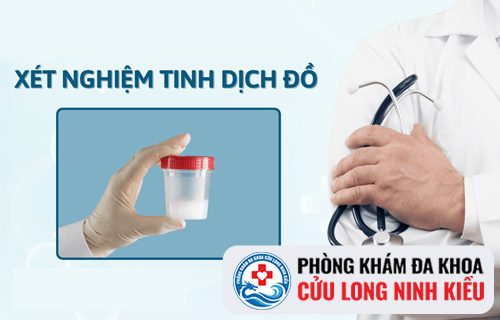 Xét nghiệm tinh dịch đồ là gì và chi phí có cao không?