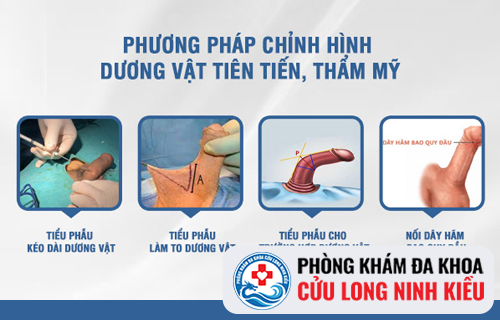 Địa Chỉ Làm To dương vật Uy Tín Tại Cần Thơ