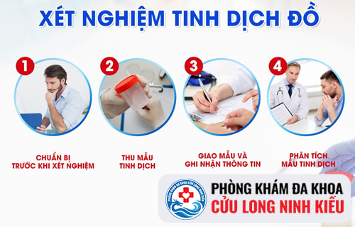 Khi nào cần xét nghiệm tinh trùng?
