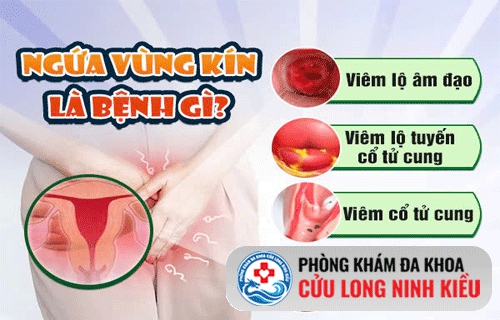 Nguyên nhân không ngờ tới và cách điều trị viêm ngứa vùng kín