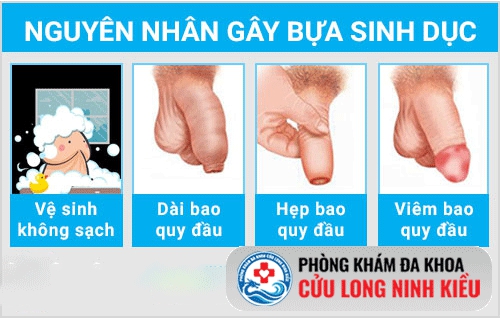 Cảnh báo bựa sinh dục quá nhiều
