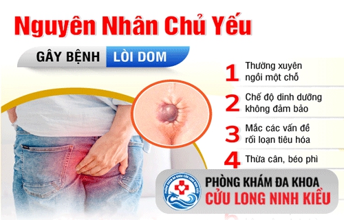 Thế nào là bệnh trĩ?