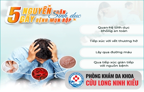Cách hỗ trợ điều trị bệnh mụn rộp sinh dục