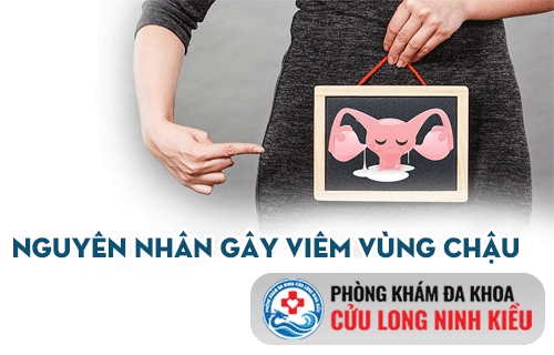 Nguyên nhân gây bệnh viêm vùng chậu