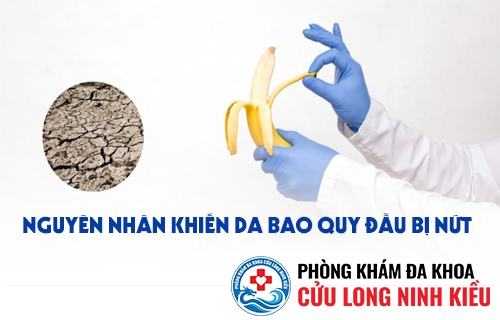 Hiện tượng khi da bao quy đầu bị nứt do đâu ?