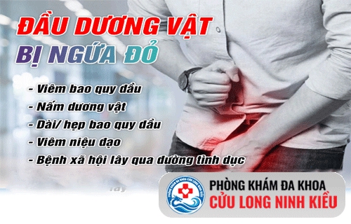 Ngứa đầu dương vật – Triệu chứng không thể bỏ qua
