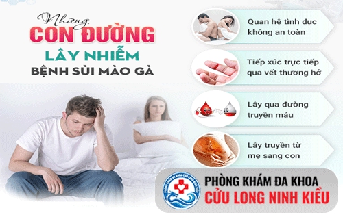 Nguyên nhân mắc bệnh sùi mào gà phổ biến hiện nay