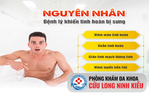 Sưng tinh hoàn là bệnh gì?