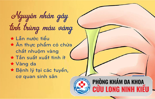 Tinh trùng màu vàng là bị gì? Hé lộ nguyên nhân ít ai ngờ tới