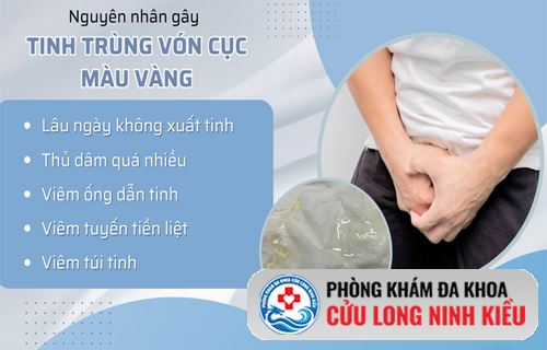 Tinh trùng vón cục màu vàng – Đừng chủ quan với dấu hiệu bất thường