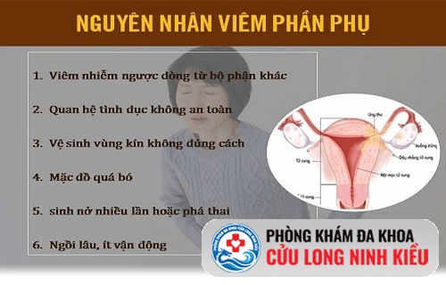 Những nguyên nhân gây viêm phần phụ