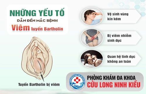 Viêm tuyến Bartholin và nguyên nhân gây bệnh