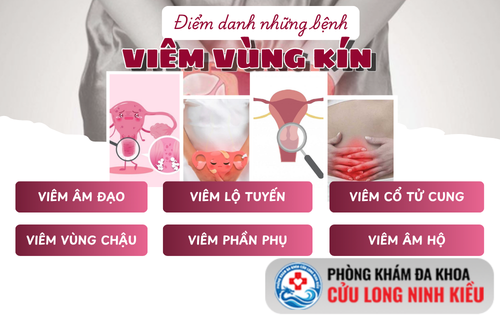 Chị em có đang ngó lơ những dấu hiệu viêm vùng kín này không?