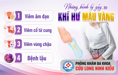 Bạn có đang gặp tình trạng khí hư màu vàng đầy lo ngại này không? Đừng vội bỏ qua